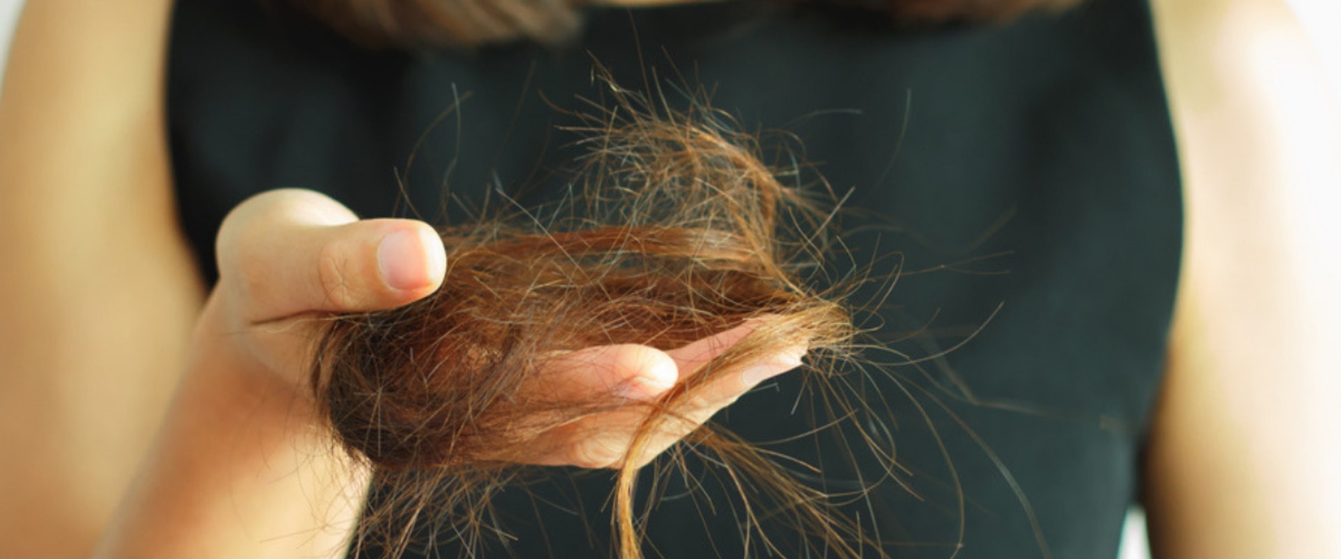How long does hair loss last after losing weight?